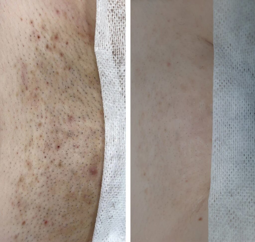 before after2 (1) before after2 (1)