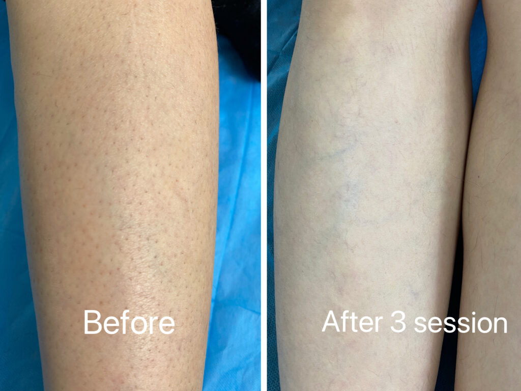 before after3 (1) before after3 (1)