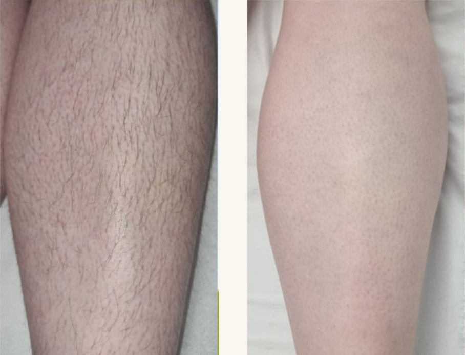 before and after4 before and after4